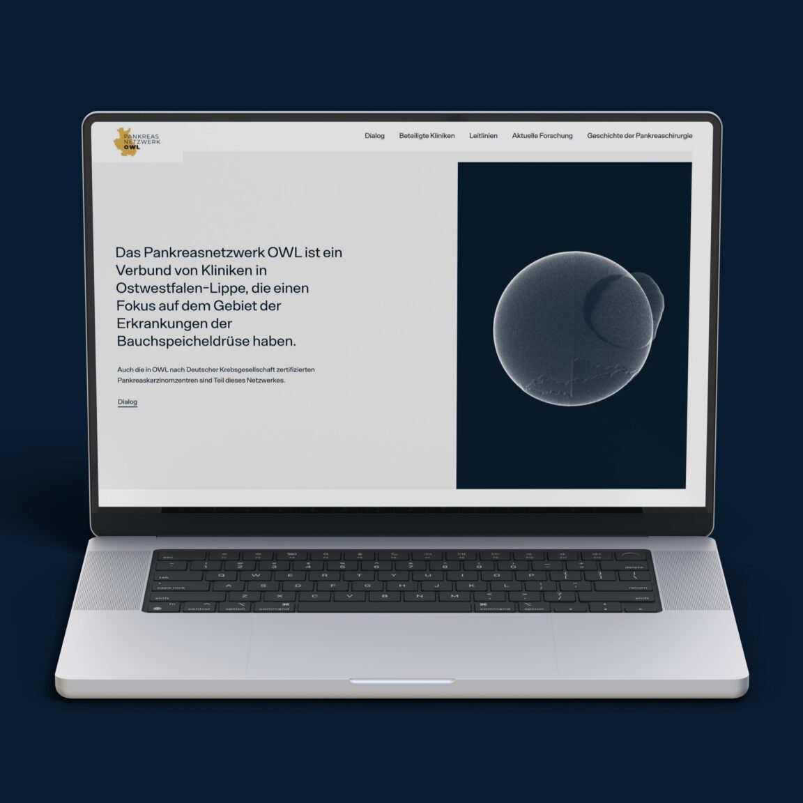 Mockup von einem Laptop auf dem die Startseite des Pankreasnetzwerks OWL zu sehen ist